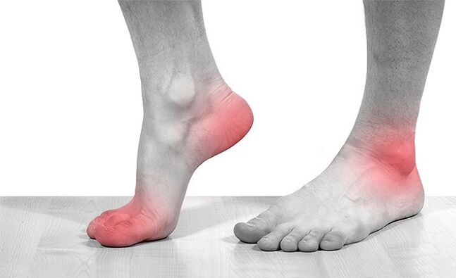 pain in the joints of the ankle with osteoarthritis