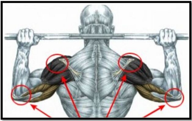 Strain on the muscles of the shoulder and elbow is one of the causes of osteoarthritis in the shoulder joint